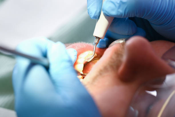 Best Weekend Emergency Dentist in Rockwell, AR