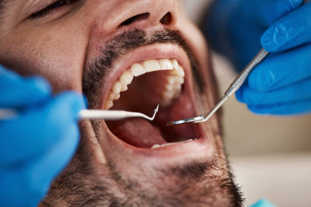Best Emergency Wisdom Teeth Removal in Rockwell, AR