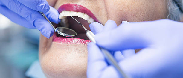 Best Emergency Dental Care for Broken or Chipped Teeth in Rockwell, AR